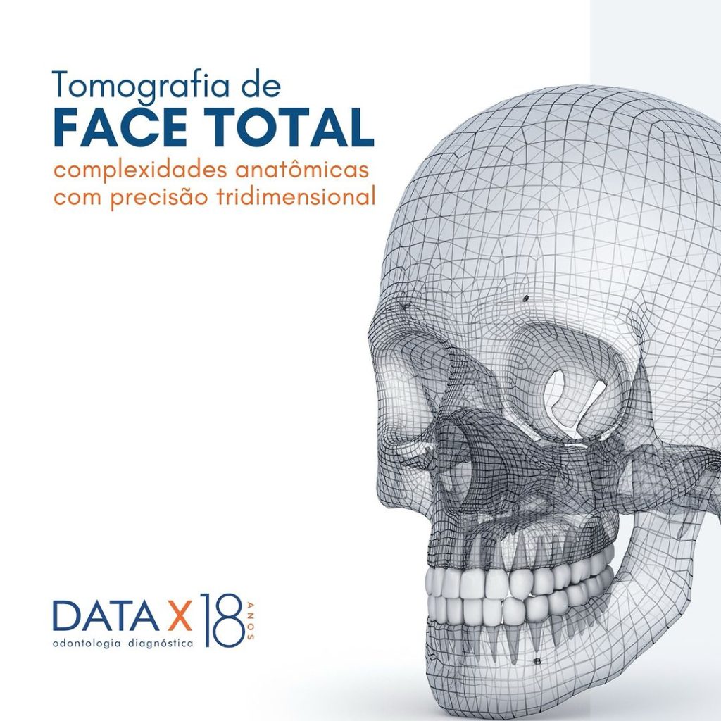 tomografia-de-face-total