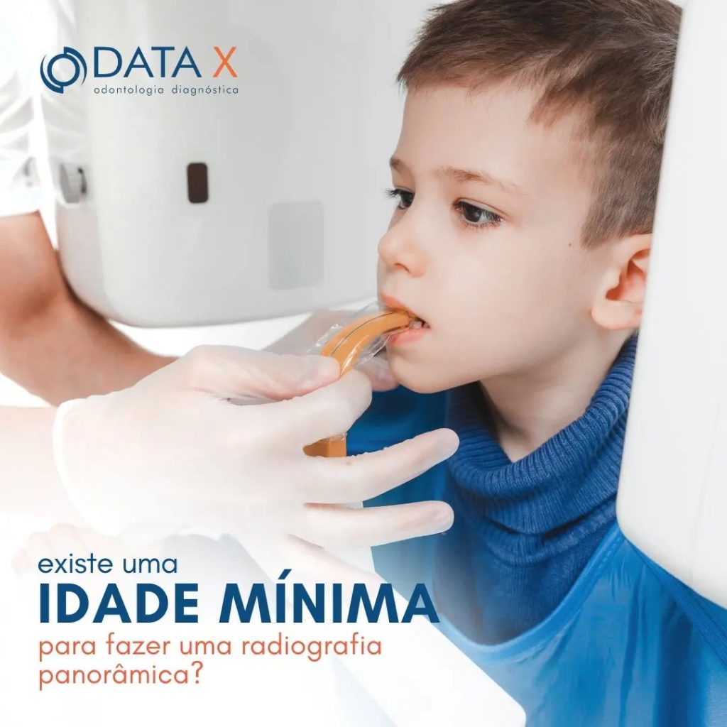 idade-para-fazer-uma-radiografia-panoramica