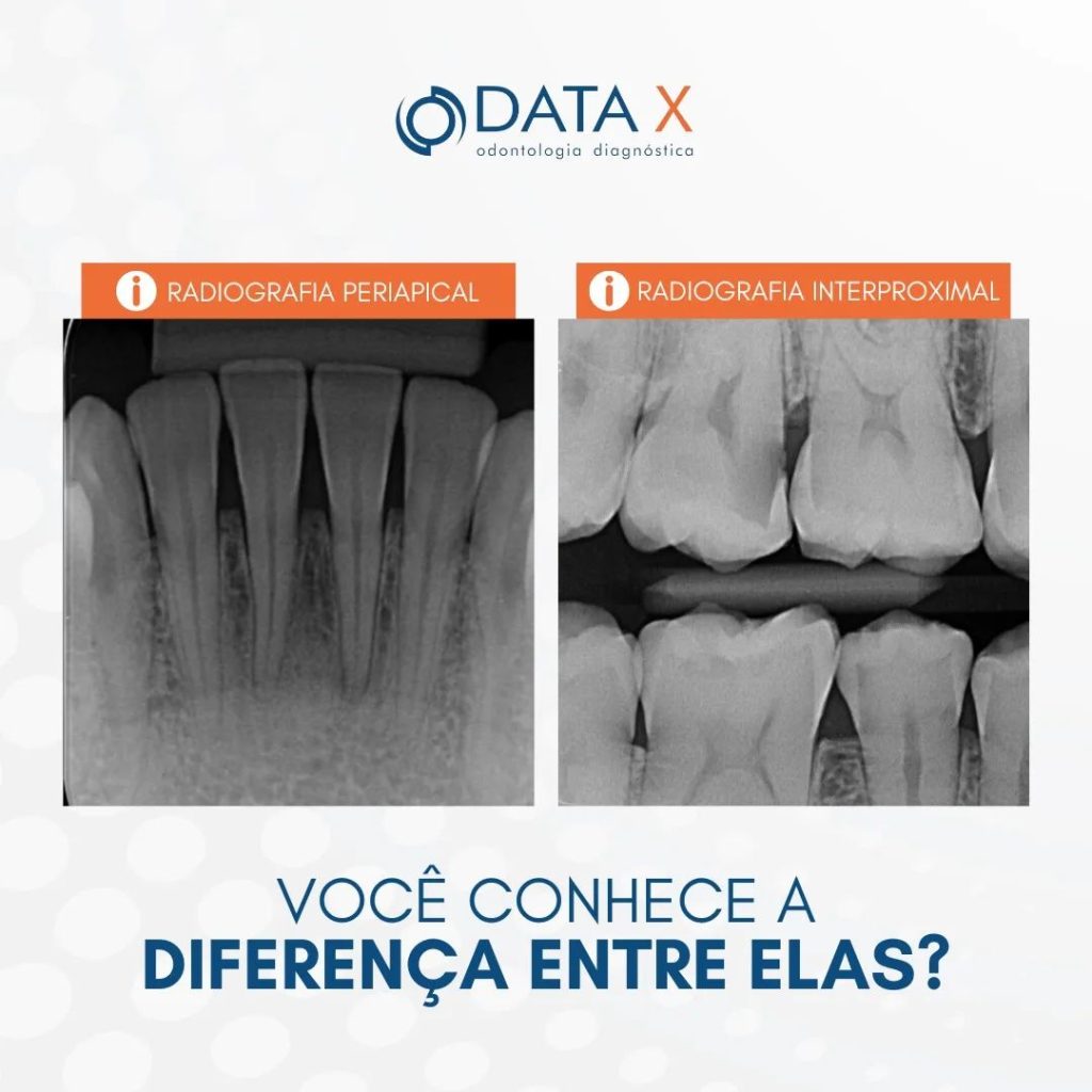 voce-conhece-a-diferenca-entre-elas-?