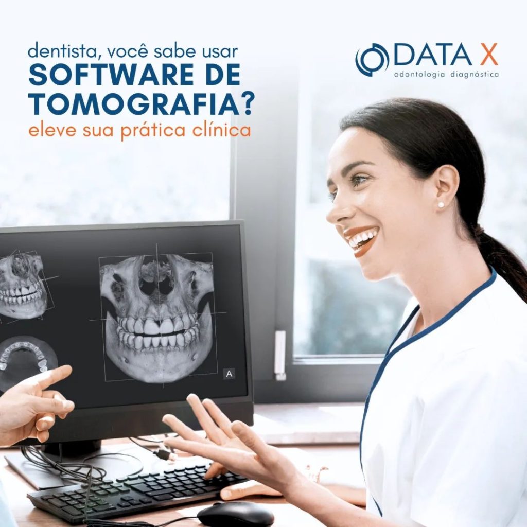 dentista-voce-sabe-usar-software-de-tomografia-?