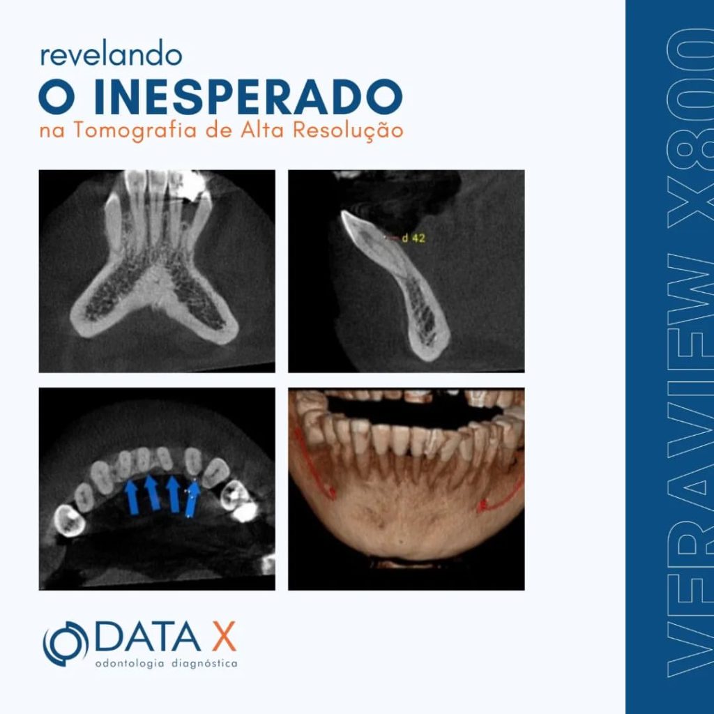 revelando-o-inesperado