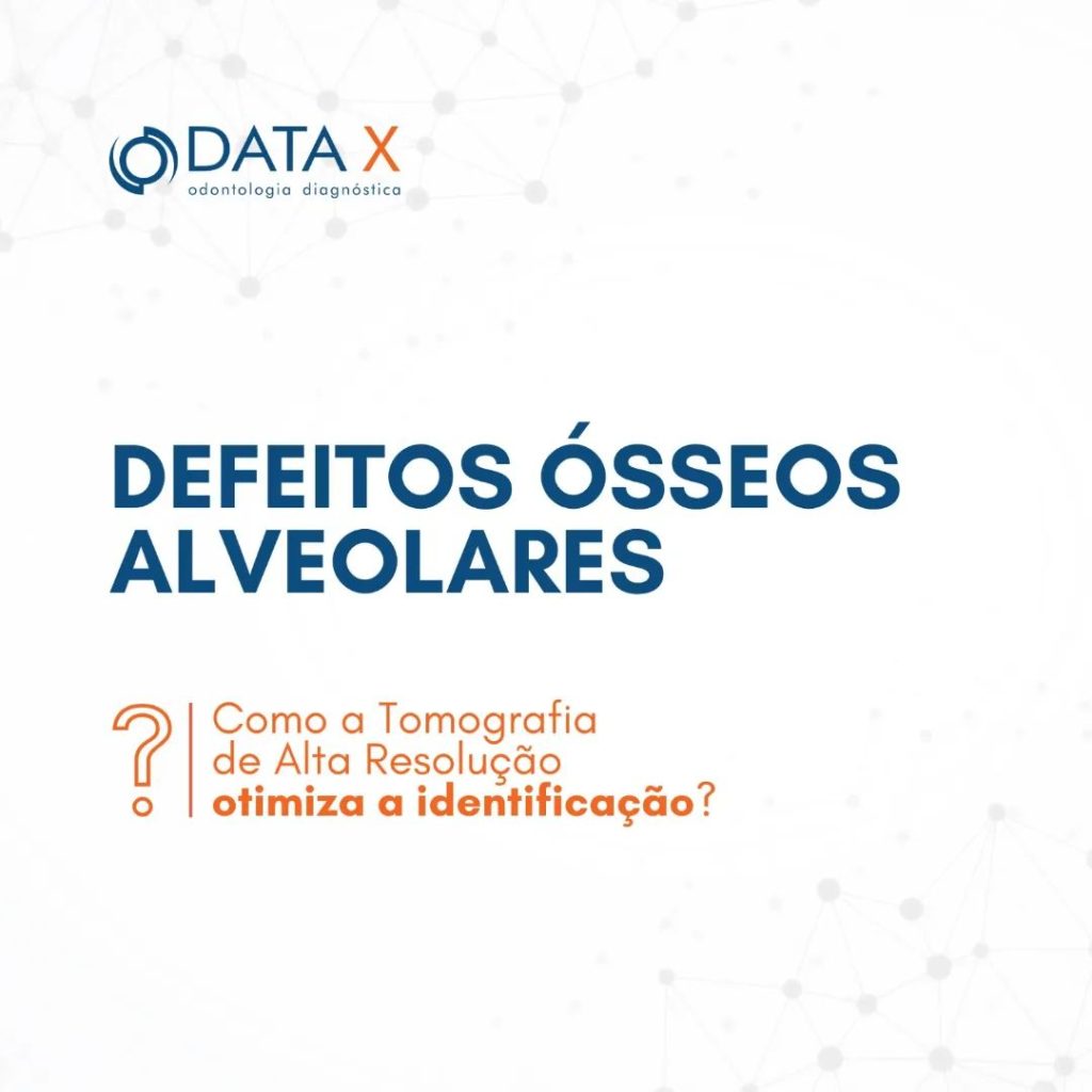 defeitos-osseos-alveolares