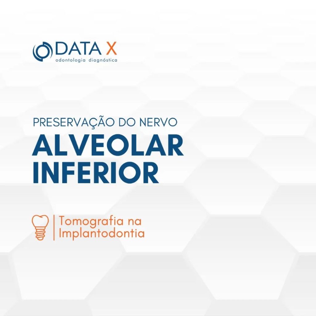 preservacao-do-nervo-alveolar-inferior