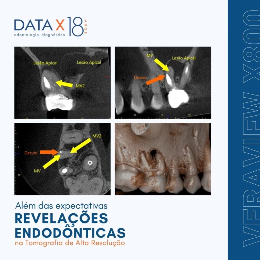 revelacoes-endodonticas