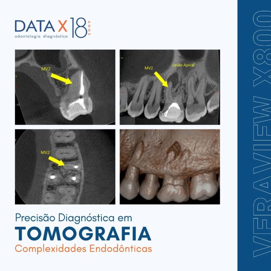 precisao-diagnostica-em-tomografia