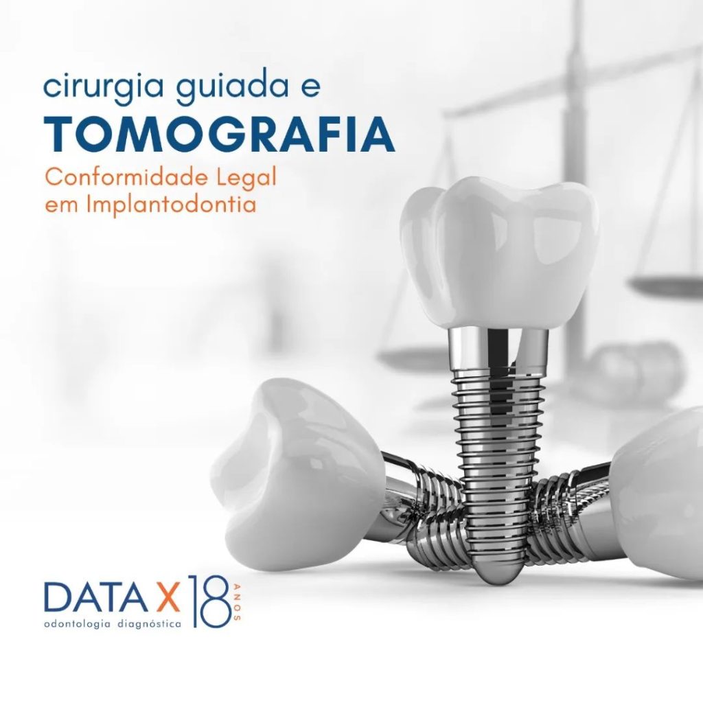 cirurgia-guiada-e-tomografia