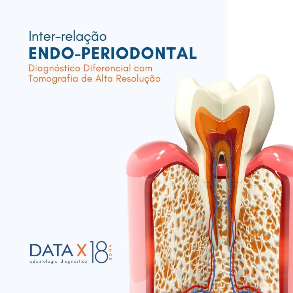 inter-relacao-endo-periodontal