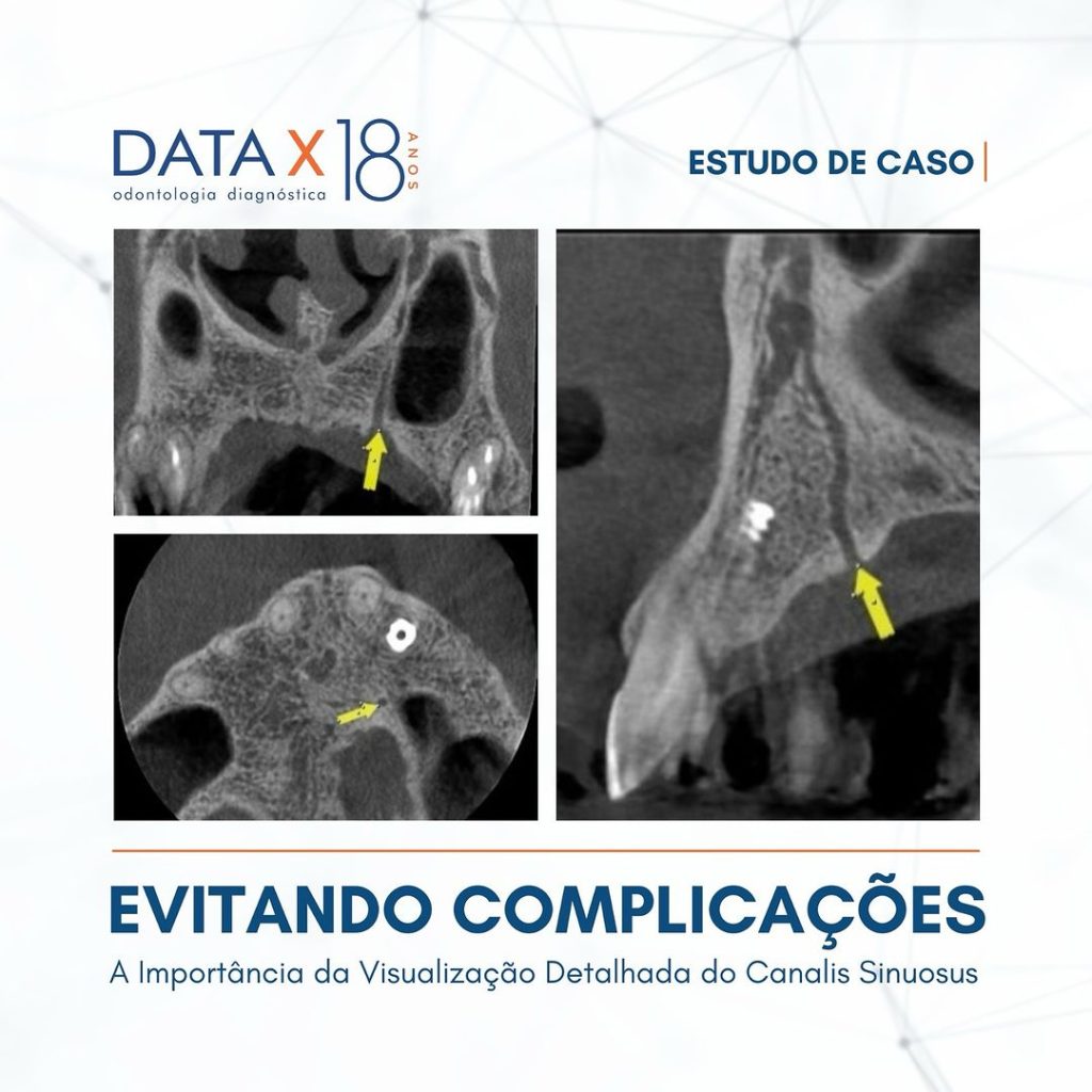 evitando-complicacoes