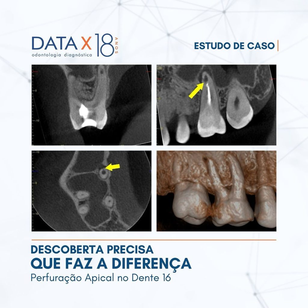 descoberta-precisa-que-faz-a-diferenca