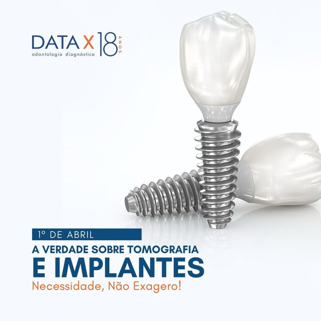 a-verdade-sobre-tomografia-e-implantes