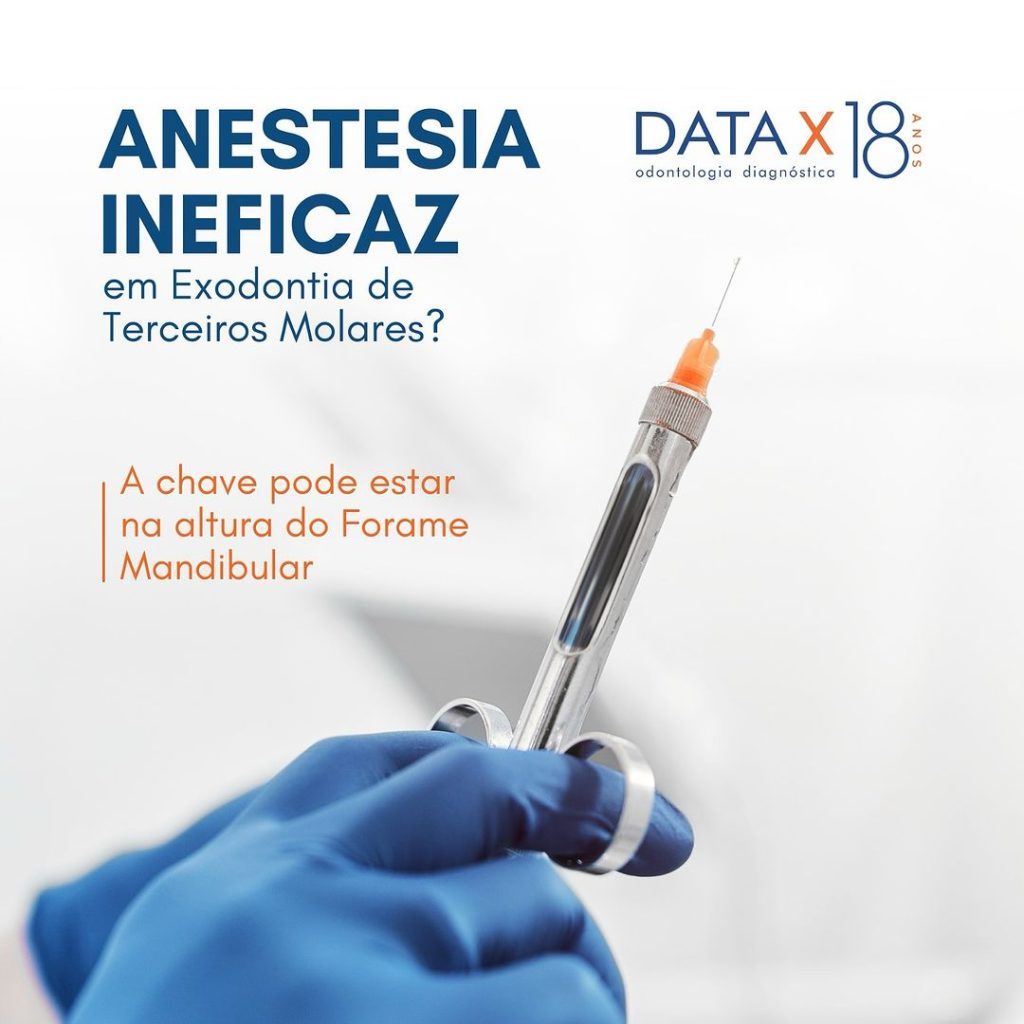 anestesia-ineficaz