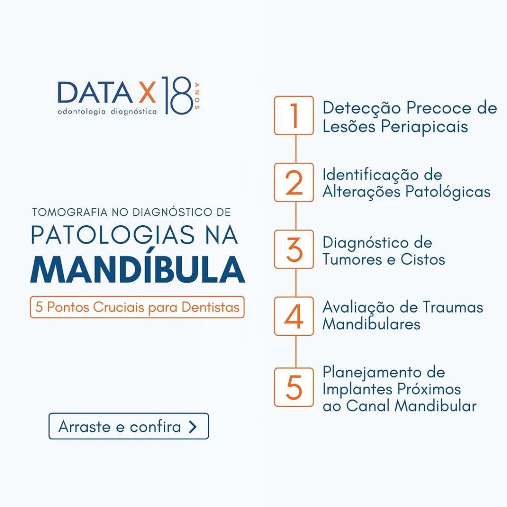 tomografia-no-diagnostico-de-patologias-na-mandibula