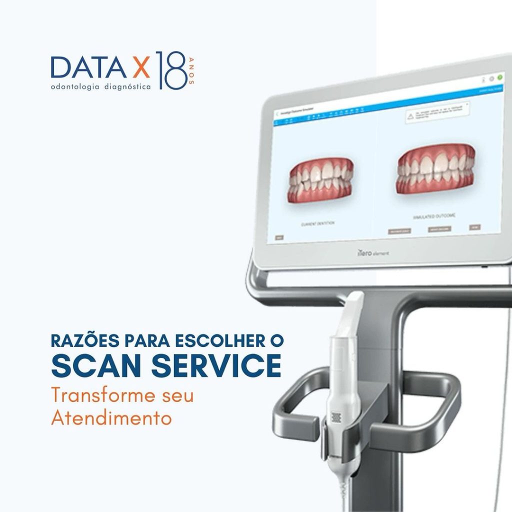 razoes-para-escolher-o-scan-service