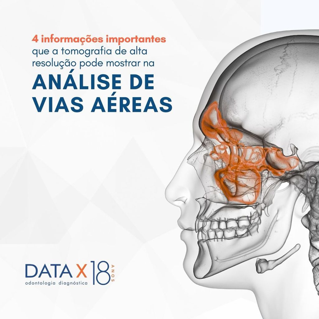 analise-de-vias-aereas