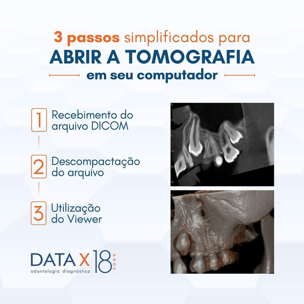 3-passos-para-abrir-a-tomografia-em-seu-computador