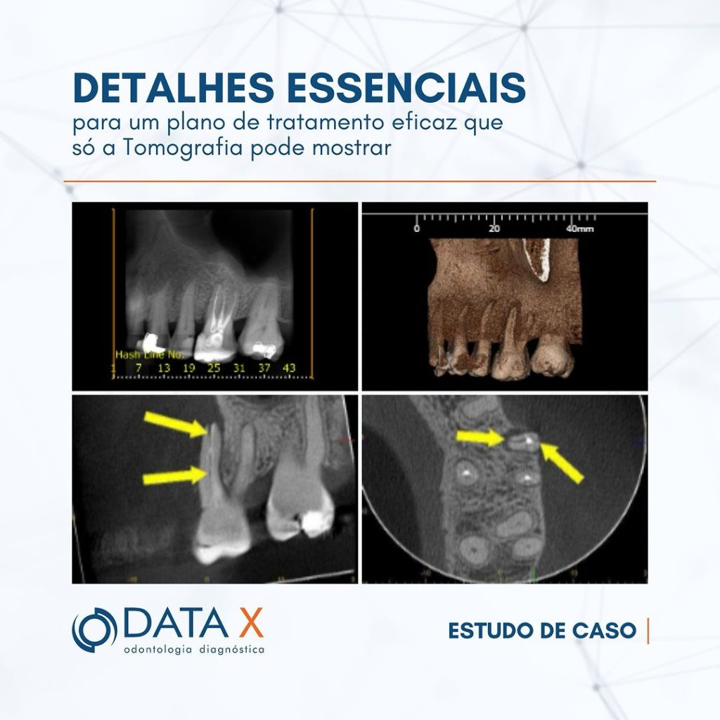 detalhes-essenciais