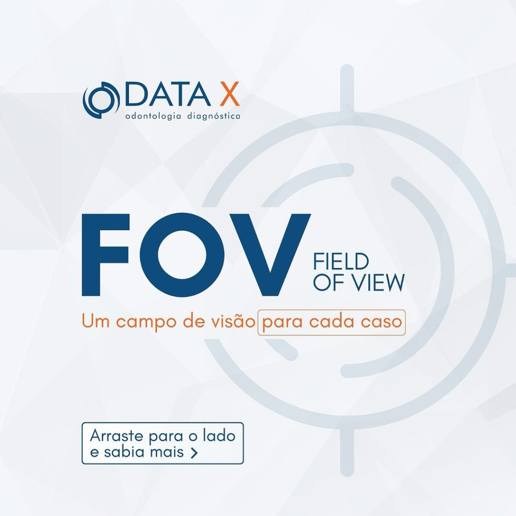 fov