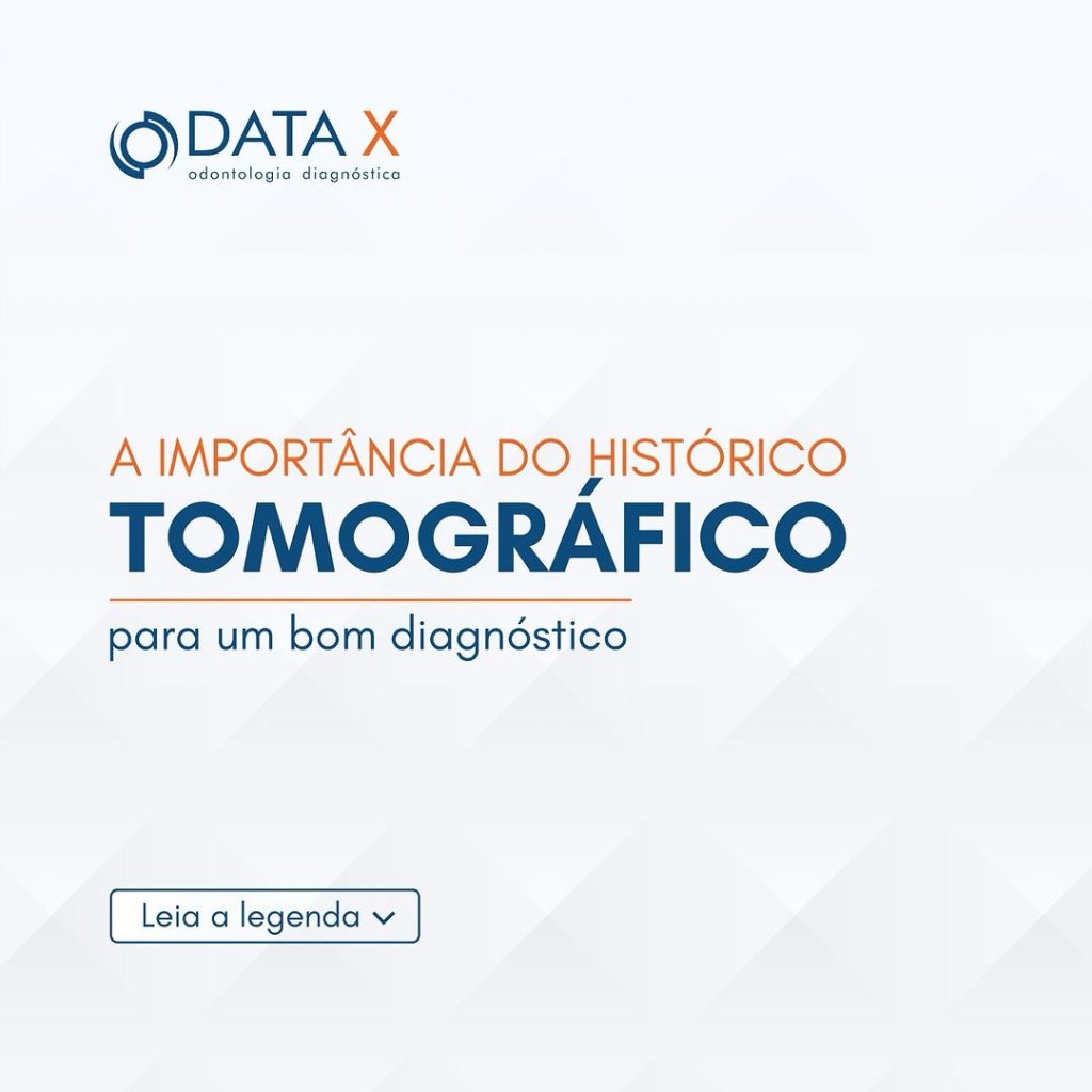 a-importancia-do-historico-tomografico