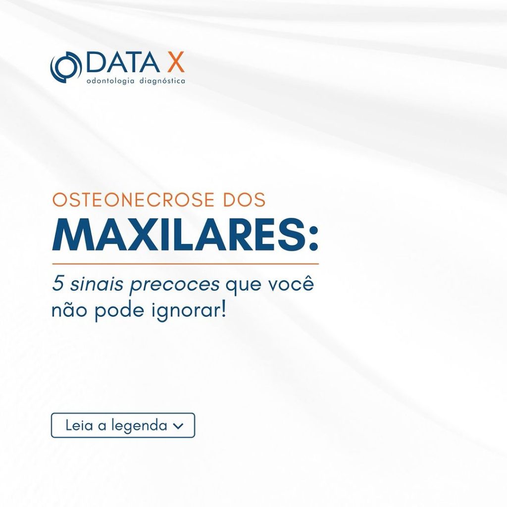 osteonecrose-dos-maxilares