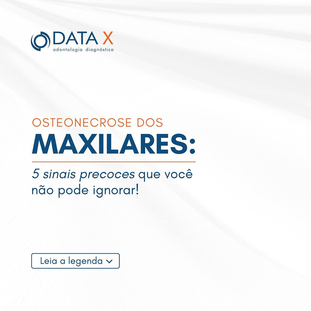 osteonecrose-dos-maxilares