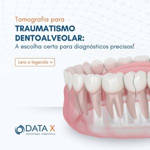 traumatismo-dentoalveolar