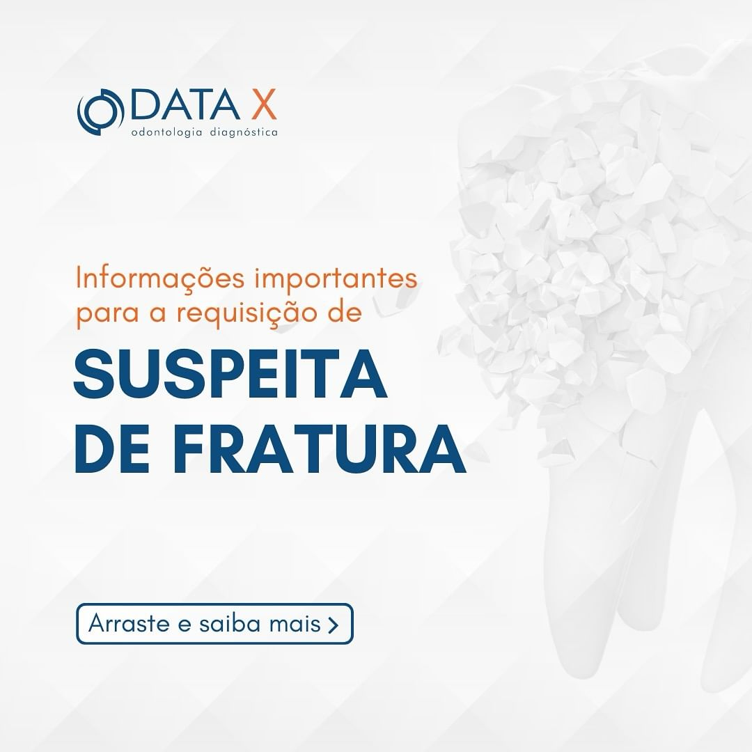 suspeita-de-fratura