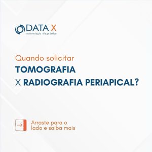 tomografia-e-radiografia-periapical