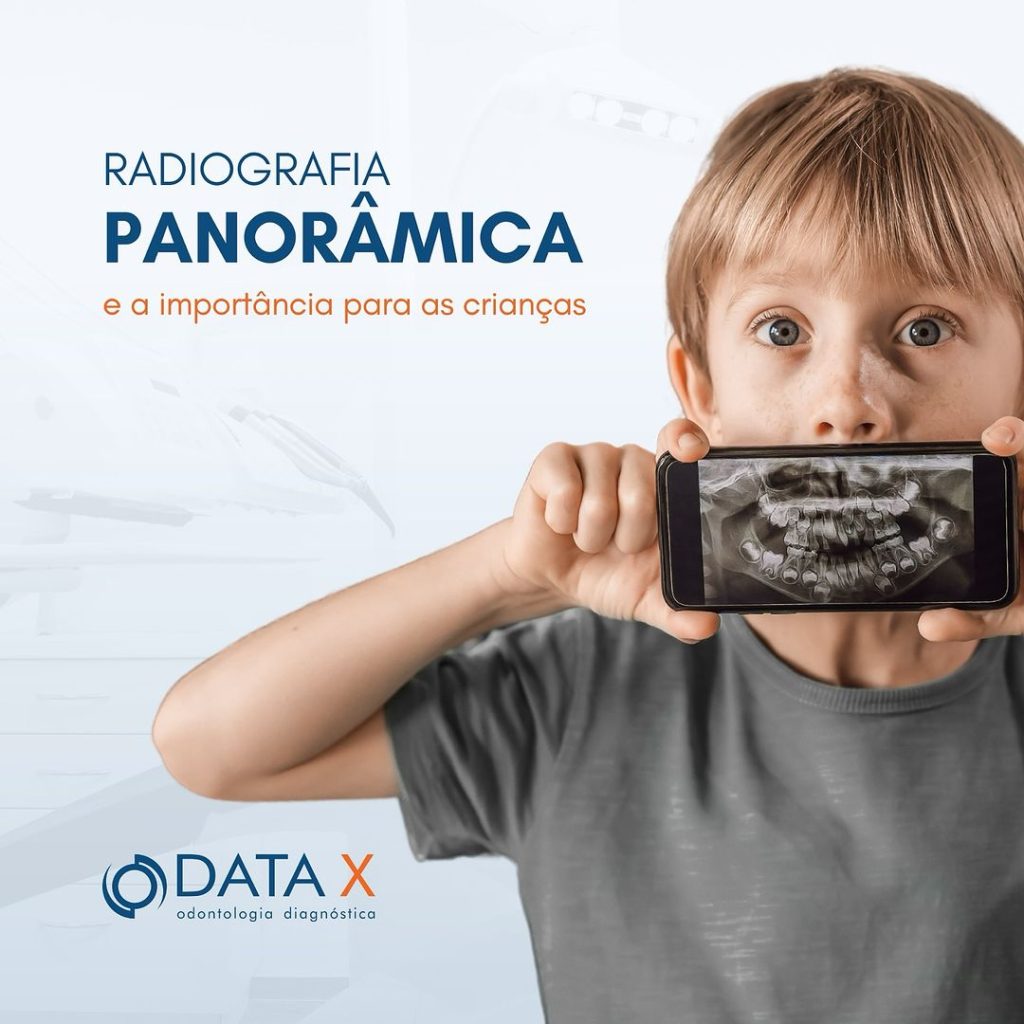 radiografia-panoramica