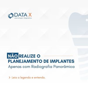 radiografia-panoramica-para-planejar-seus-implantes-?