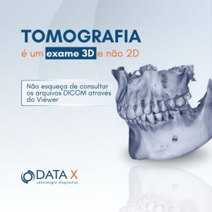 tomografia-e-um-exame-3d-e-nao-2d