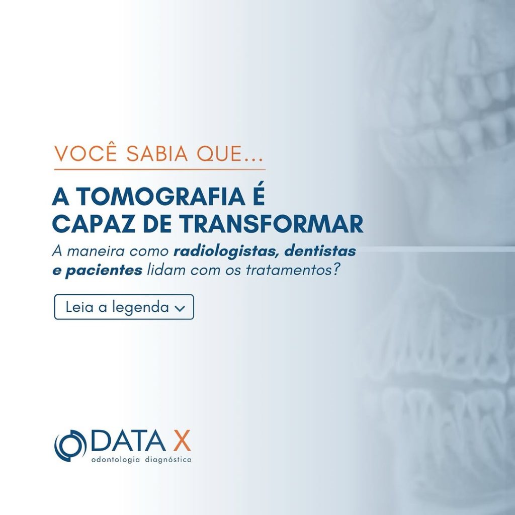 tomografia-odontologica