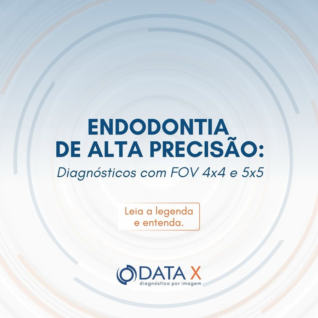 endodontia-de-alta-precisao