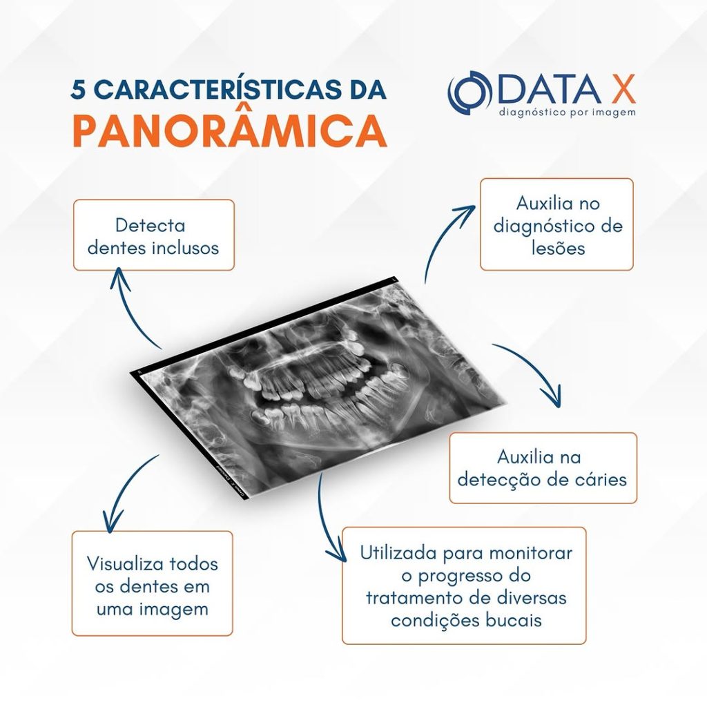 5-caracteristicas-da-panoramica