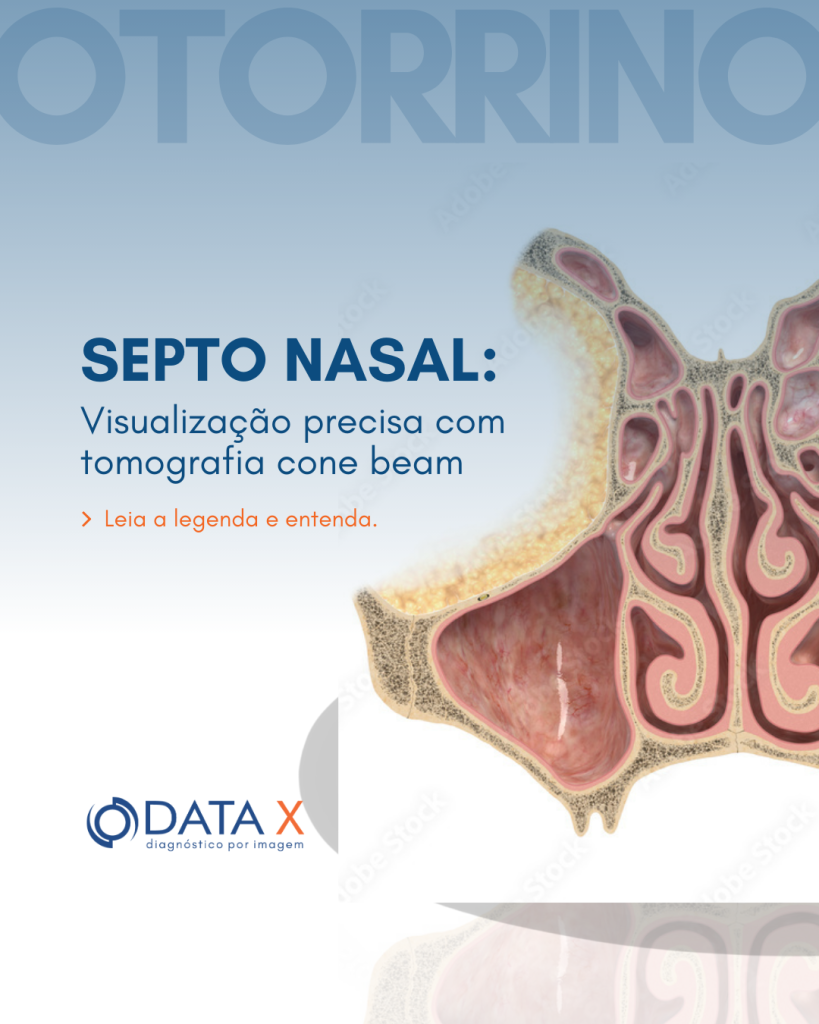 septo-nasal