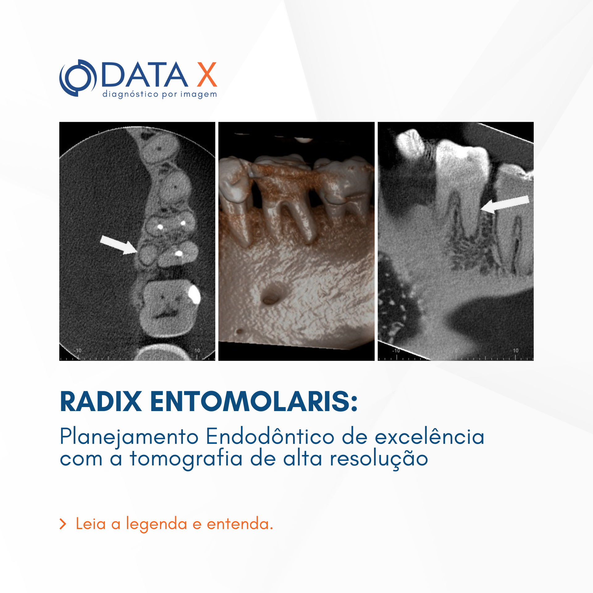 radix-entomolaris