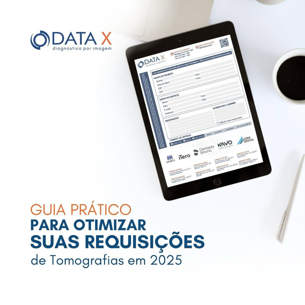 guia-pratico-para-otimizar-suas-requisicoes