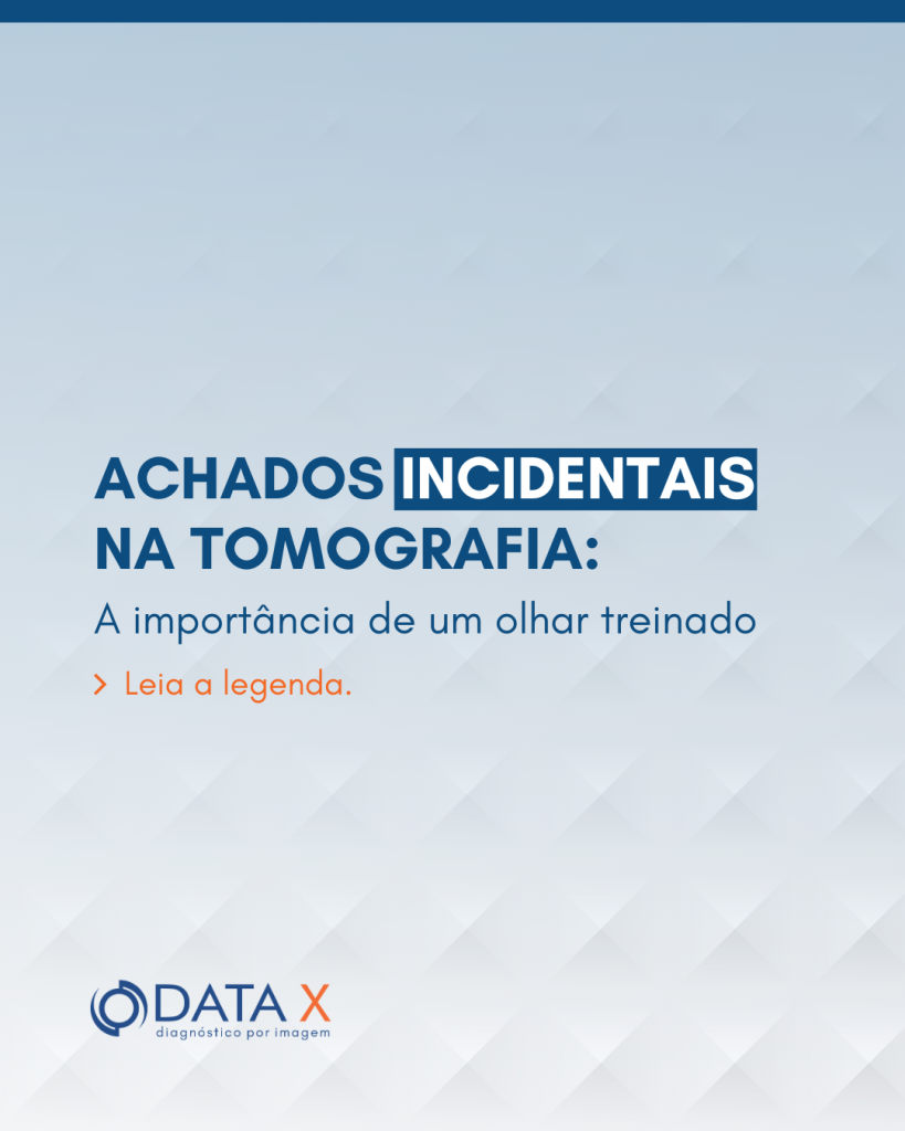 achados-incidentais-na-tomografia