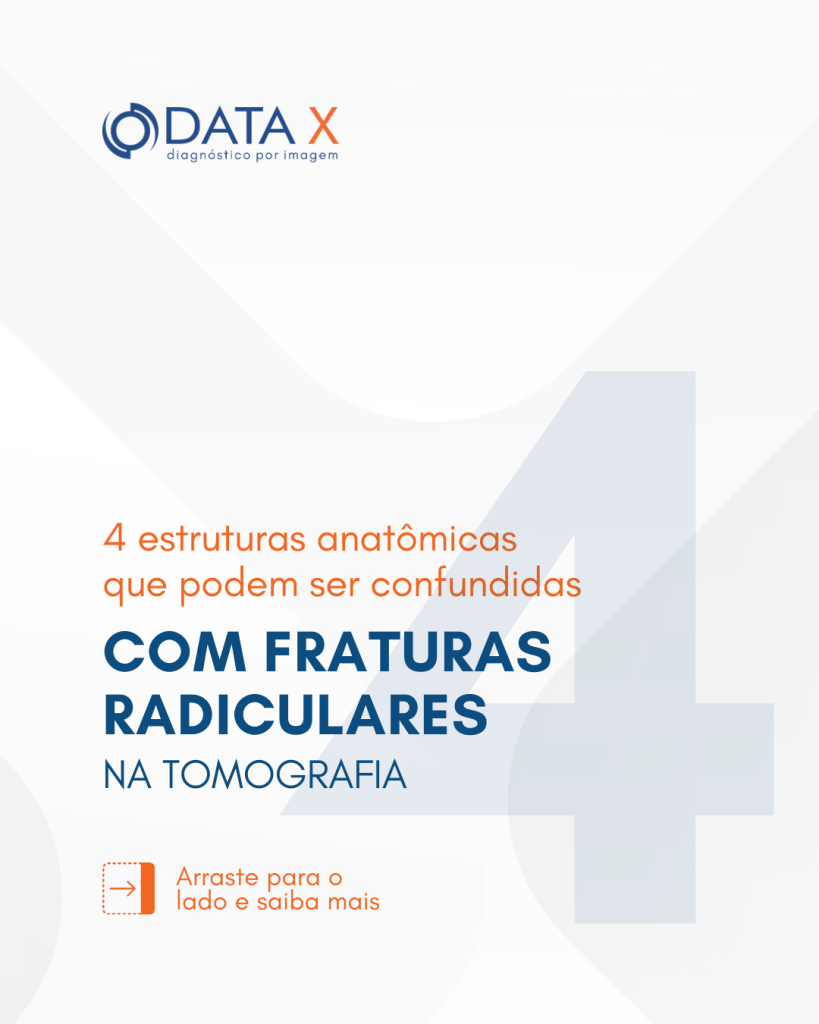 fraturas-radiculares-na-tomografia