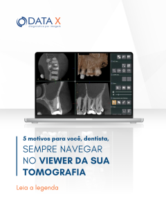 motivos-para-navegar-no-viewer-da-sua-tomografia