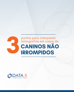 casos-de-caninos-nao-irrompidos