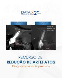 recurso-de-reducao-de-artefatos