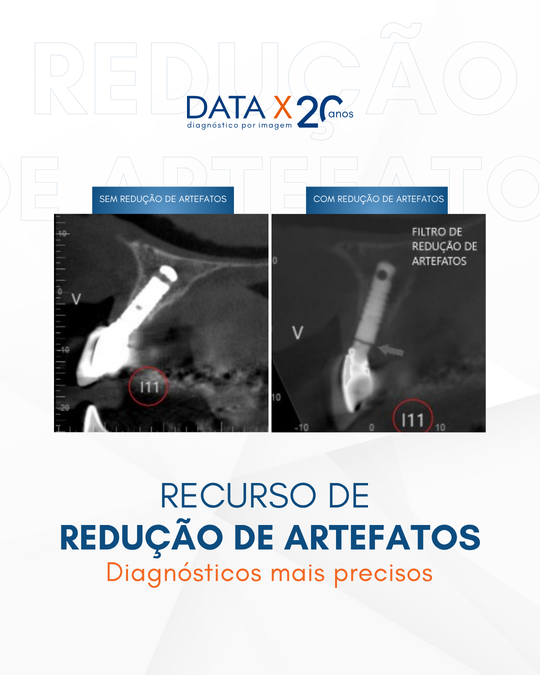 recurso-de-reducao-de-artefatos