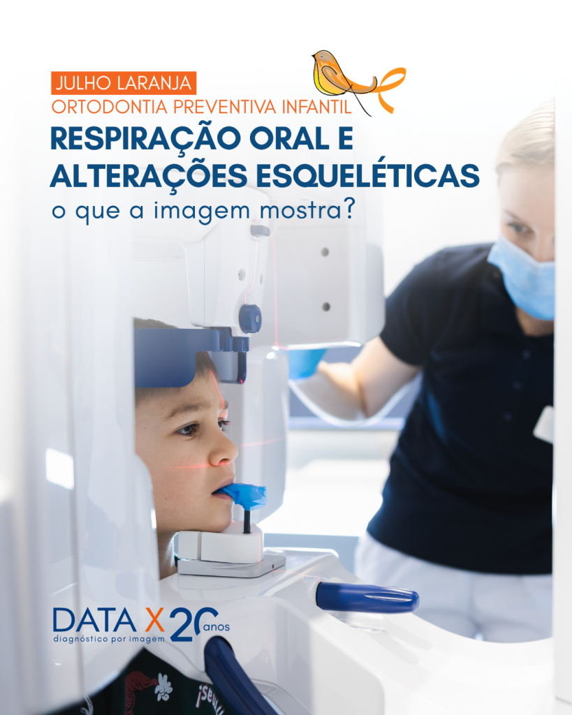 respiracao-oral-e-alteracoes-esqueleticas
