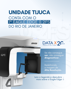 1o-eagle-edge-0-2-fs-do-rj