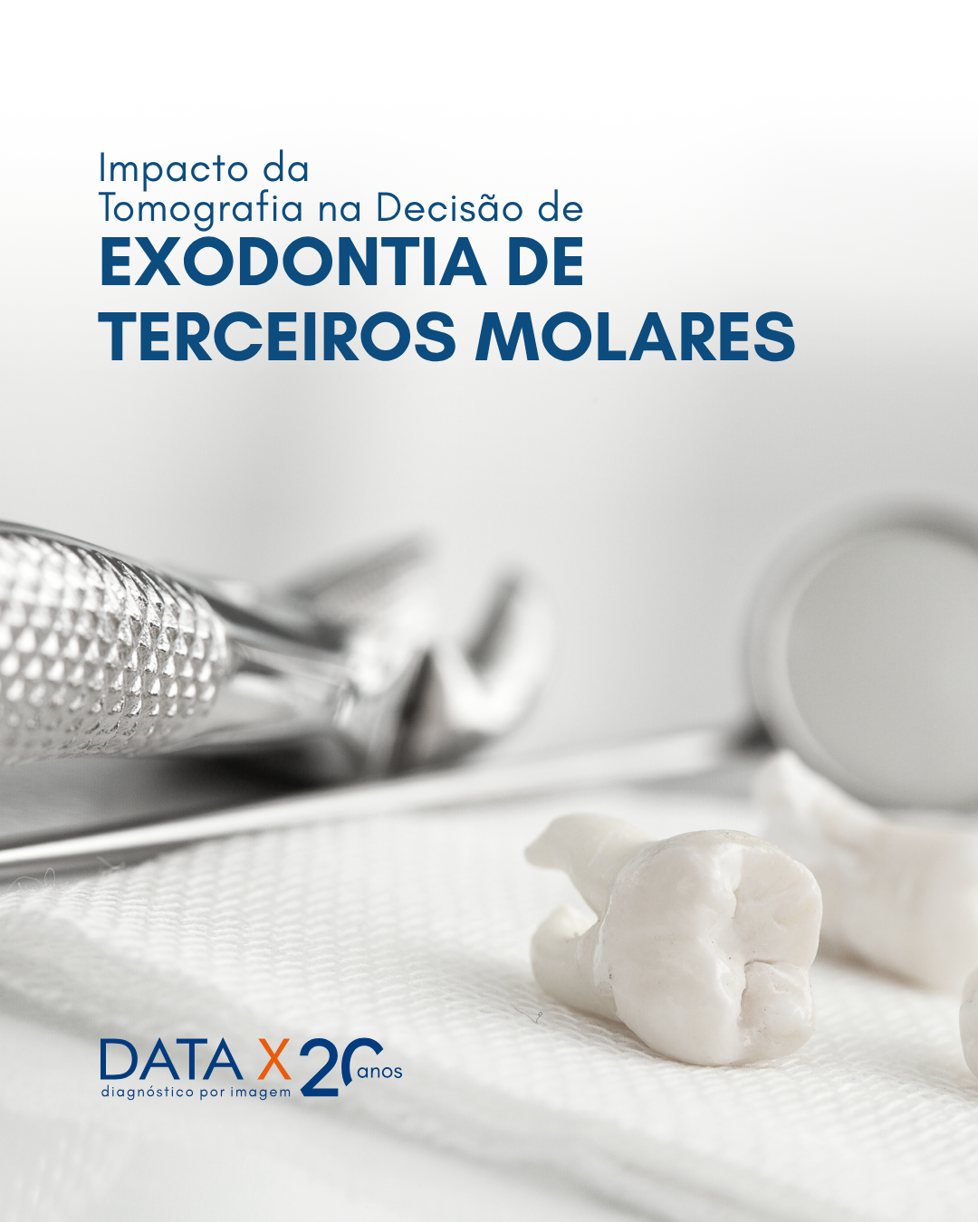 exodontia-de-terceiros-molares