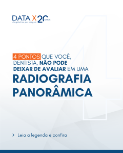 4-pontos-da-radiografia-panoramica