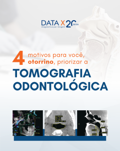tomografia-na-otorrinolaringologia