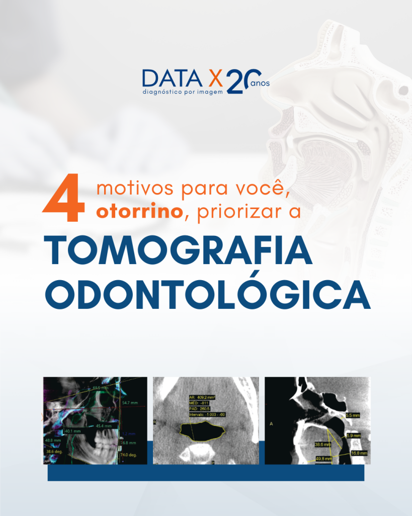 tomografia-na-otorrinolaringologia