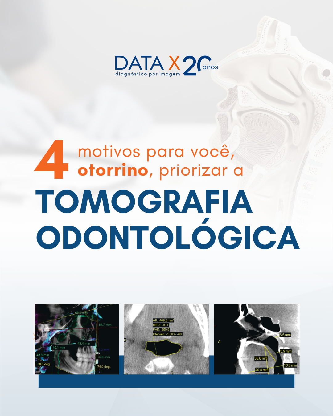 tomografia-na-otorrinolaringologia